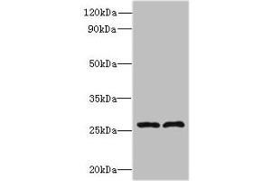 Western blot All lanes: FAM71C antibody at 6 μg/mL Lane 1: 293T whole cell lysate Lane 2: Jurkat whole cell lysate Secondary Goat polyclonal to rabbit IgG at 1/10000 dilution Predicted band size: 28 kDa Observed band size: 28 kDa (FAM71C anticorps  (AA 1-241))