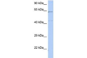 WB Suggested Anti-EME1 Antibody Titration: 0. (Crossover junction endonuclease EME1 (EME1) (Middle Region) anticorps)