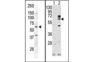Image no. 2 for anti-RYK Receptor-Like Tyrosine Kinase (RYK) (AA 150-200) antibody (ABIN359937) (RYK anticorps  (AA 150-200))