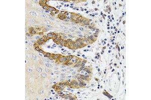Immunohistochemistry of paraffin-embedded Human trachea using ESD antibody. (Esterase D anticorps  (AA 1-282))