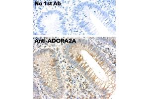 Immunohistochemistry (IHC) image for anti-Adenosine A2a Receptor (ADORA2A) (C-Term) antibody (ABIN7272985)