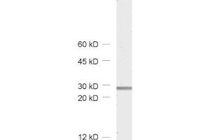 dilution: 1 : 1000, sample: rat brain homogenate (Calretinin anticorps)