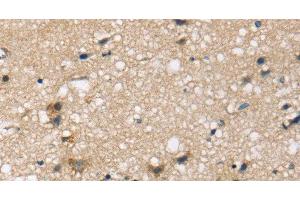 Immunohistochemistry of paraffin-embedded Human brain tissue using SEMA4A Polyclonal Antibody at dilution 1:45 (Sema4a anticorps)