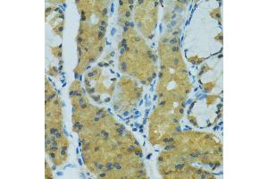Immunohistochemistry of paraffin-embedded human stomach using CYP2B6 antibody (ABIN5997556) at dilution of 1/100 (40x lens). (CYP2B6 anticorps)