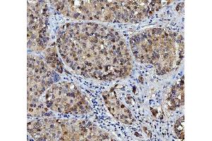 IHC analysis of FEN1 using anti-FEN1 antibody (ABIN7601619). (FEN1 anticorps  (AA 4-300))