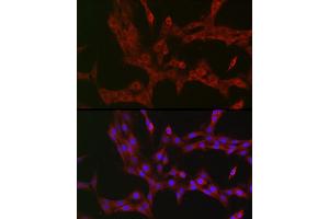 anti-NFKB Inhibitor Interacting Ras-Like 1 (NKIRAS1) (AA 118-192) antibody