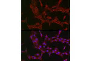 Immunofluorescence analysis of PC-12 cells using NKIR Rabbit pAb (ABIN7268903) at dilution of 1:100 (40x lens). (NKIRAS1 anticorps  (AA 118-192))