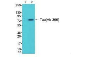 Western blot analysis of extracts from 293 cells (Lane 2), using Tau (Ab-396) antiobdy. (MAPT anticorps  (Ser396))