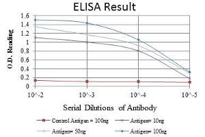 Red: Control Antigen (100 ng), Purple: Antigen (10 ng), Green: Antigen (50 ng), Blue: Antigen (100 ng), (CBL anticorps)
