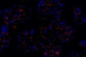 Immunofluorescent analysis of paraformaldehyde-fixed human placenta using PTGFR (ABIN7075209) at dilution of 1: 800 (PTGFR anticorps)