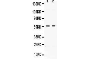 Western blot analysis of BMP15 expression in HELA whole cell lysates ( Lane 1) and MCF-7 whole cell lysates ( Lane 2).