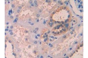 Detection of IL1RAP in Human Kidney Tissue using Polyclonal Antibody to Interleukin 1 Receptor Accessory Protein (IL1RAP)