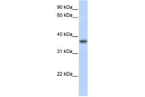 WB Suggested Anti-TMEM173 Antibody Titration:  0.