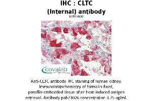 Image no. 2 for anti-Clathrin Heavy Chain (CLTC) (C-Term), (Internal Region) antibody (ABIN1733162) (Clathrin Heavy Chain (CLTC) (C-Term), (Internal Region) anticorps)