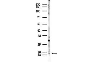 anti-Epithelial Membrane Protein 3 (EMP3) antibody