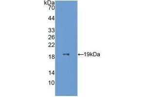 Detection of Recombinant ESM1, Human using Polyclonal Antibody to Endothelial Cell Specific Molecule 1 (ESM1) (ESM1 anticorps  (AA 20-184))