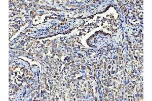 IHC analysis of Asparagine synthetase/ASNS using anti-Asparagine synthetase/ASNS antibody (ABIN7599465).