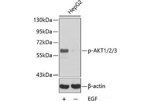 Western blot analysis of extracts HepG2 cells using Phospho-AKT1(Y315)/AKT2(Y316)/AKT3(Y312) Polyclonal Antibody. (AKT1 anticorps  (pTyr312, pTyr315, pTyr316))