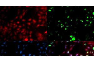 Immunofluorescence analysis of GFP-RNF168 transgenic U2OS cells using POLK Polyclonal Antibody (POLK anticorps)