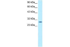 RGS16 antibody used at 1 ug/ml to detect target protein. (RGS16 anticorps  (C-Term))