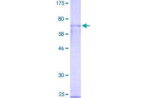 SDS-PAGE (SDS) image for Nuclear Receptor Subfamily 0, Group B, Member 1 (NR0B1) (AA 1-470) protein (GST tag) (ABIN1775206)