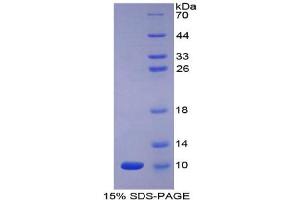 SDS-PAGE analysis of Human Apelin Protein.