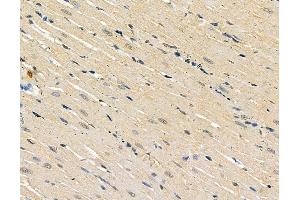 ABIN6264335 and ABIN6279358 at 1/100 staining rat heart tissue by IHC-P.