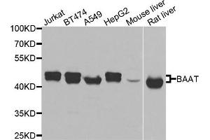 Western blot analysis of extracts of various cells, using BAAT antibody.