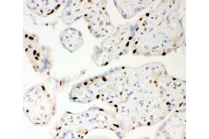 IHC-P: PARP antibody testing of human placenta tissue