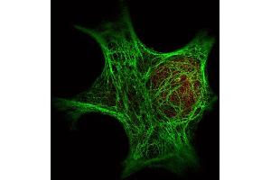 Immunofluorescence Microscopy of  Immunochemical's Anti-Keratin antibody () was used with  Dylight 488 goat anti-mouse 610-141-121 (shown in green) to detect Keratin by Immunofluorescence.