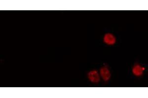 ABIN6274168 staining HeLa cells by IF/ICC.