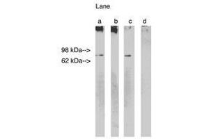 Image no. 1 for anti-Ceramide Synthase 1 (CERS1) antibody (ABIN793692) (LASS1 anticorps)