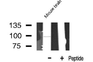 Western blot analysis of LTK expression in Mouse Brain lysate