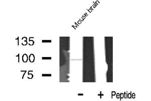 Western blot analysis of LTK expression in Mouse Brain lysate (LTK anticorps  (Internal Region))