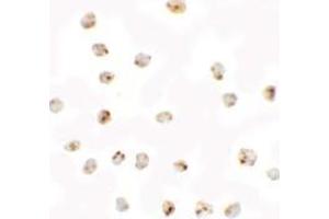 Immunocytochemistry of BMP15 in 3T3 cells with BMP15 antibody at 2.