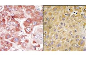 Image no. 1 for anti-G Protein-Coupled Receptor Kinase 7 (GRK7) (C-Term) antibody (ABIN360010)