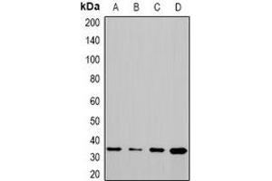 Western blot analysis of CHIP expression in Hela (A), PC12 (B), COS7 (C), mouse liver (D) whole cell lysates. (STUB1 anticorps)