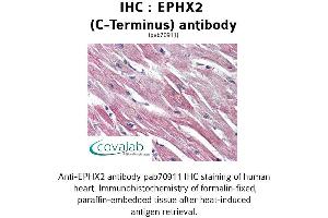 Image no. 1 for anti-Epoxide Hydrolase 2, Cytoplasmic (EPHX2) (C-Term) antibody (ABIN1734088)