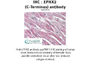 Image no. 1 for anti-Epoxide Hydrolase 2, Cytoplasmic (EPHX2) (C-Term) antibody (ABIN1734088) (EPHX2 anticorps  (C-Term))