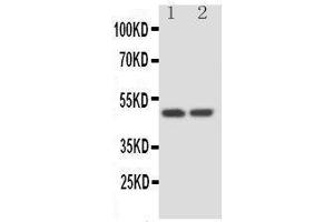 Anti-Kallistatin antibody, Western blotting Lane 1: HELA Cell Lysate Lane 2: SKOV Cell Lysate (SERPINA4 anticorps  (C-Term))
