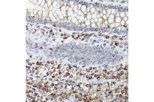 Immunohistochemistry of paraffin-embedded human appendix(400X) using Bcl-2 antibody (ABIN7265810) at dilution of 1:100 (40x lens).