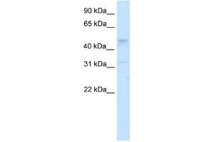 WB Suggested Anti-TCFAP2C Antibody Titration:  2. (TFAP2C anticorps  (N-Term))