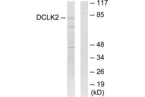 Western Blotting (WB) image for anti-Doublecortin-Like Kinase 2 (DCLK2) (N-Term) antibody (ABIN1849774) (DCLK2 anticorps  (N-Term))