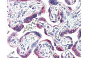 Anti-CYP26A1 antibody IHC of human placenta.