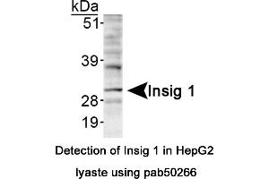 Image no. 1 for anti-Insulin Induced Gene 1 (INSIG1) (AA 1-100), (Internal Region) antibody (ABIN363575) (INSIG1 anticorps  (Internal Region))