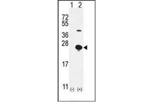 Western blot analysis of EPGN (arrow) using Epigen Antibody (N-term) Cat. (Epigen anticorps  (N-Term))