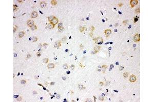 IHC-P: PAK6 antibody testing of rat brain tissue (PAK6 anticorps  (N-Term))