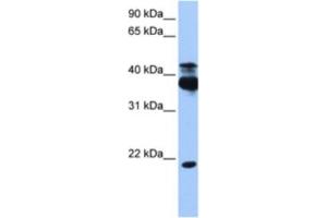 Western Blotting (WB) image for anti-serine/threonine Kinase 38 (STK38) antibody (ABIN2463209) (STK38 anticorps)