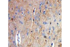 Used in DAB staining on fromalin fixed paraffin-embedded Brain tissue (Tachykinin 3 anticorps  (AA 29-101))