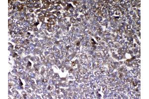 IHC analysis of Vitamin D Binding protein using anti-Vitamin D Binding protein antibody .